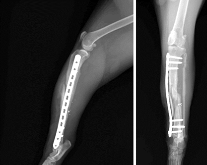Figure 4 : Ostéosynthèse après la chirurgie