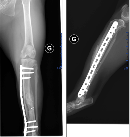 Figure 5 : Ostéosynthèse 6 semaines post-opératoires
